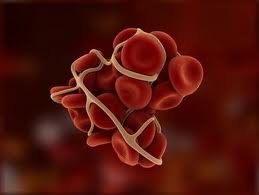 antikoagulancia-leky-na-snizeni-srazlivosti-krve-redeni-krve-informace