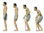 bechterevova-choroba-anyklozujicic-spondylitida-pricina-priznaky-projevy-lecba